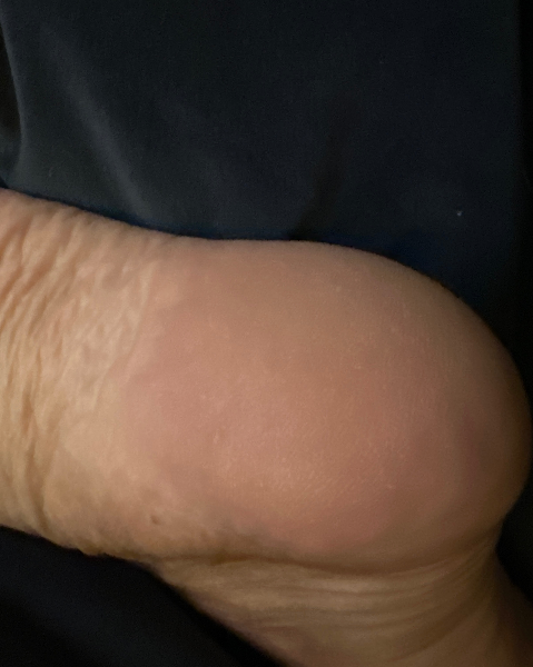 First pic.  Nervous. What do you all think. 