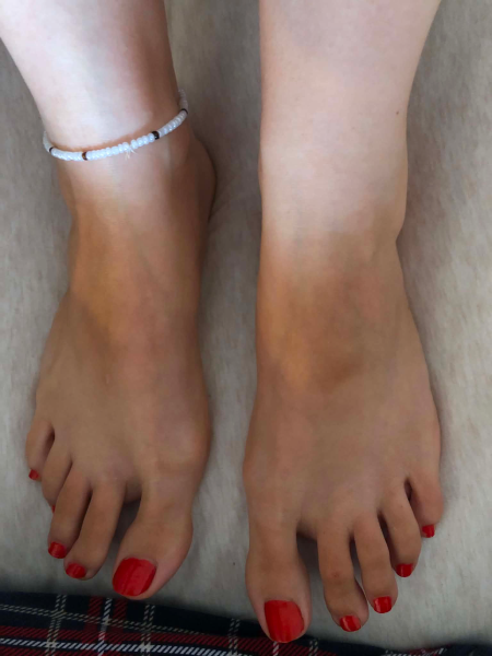 Red toenails