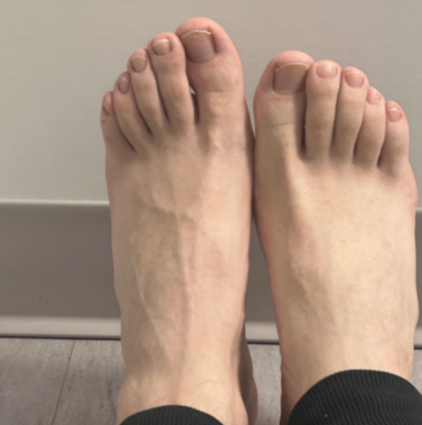 Stretched out feet!