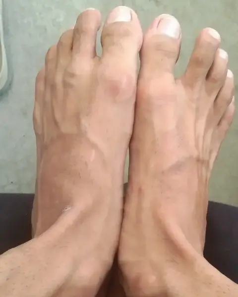 Rate my veiny feet XD
