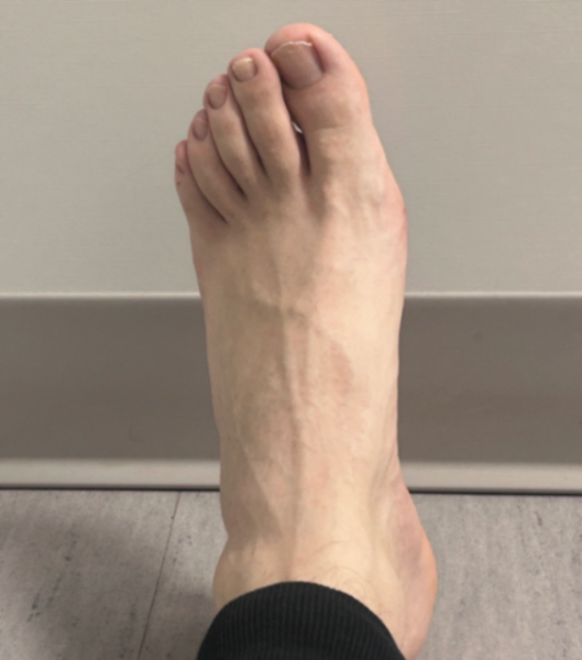 Presenting.. my foot