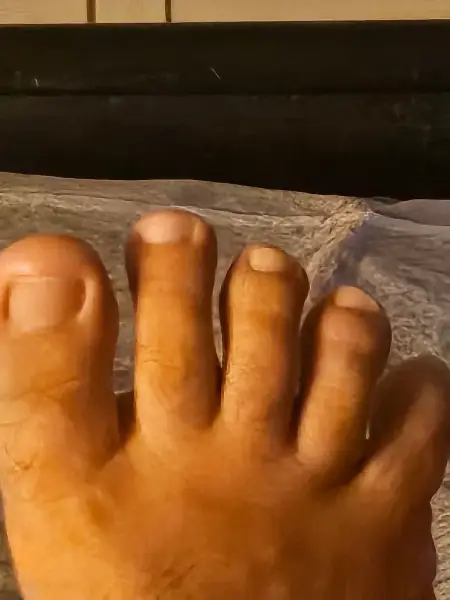 Close-up