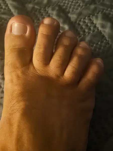 Close-up