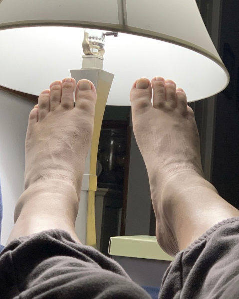 Toes 