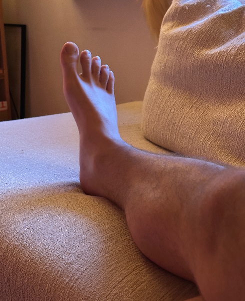 Leg