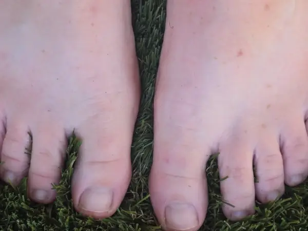 Feet by LADYTine, ranked #8